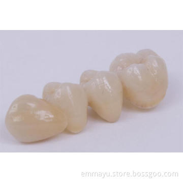 Porcelain Teeth Cercon